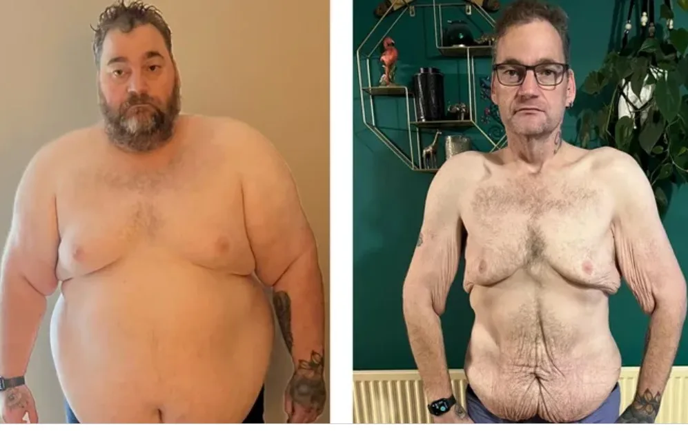 Before and after for Wayne Shepherd: “I know I got myself in to this mess by putting the weight on in the first place but it’s not that simple at all. there was so many more factors than just over eating.”